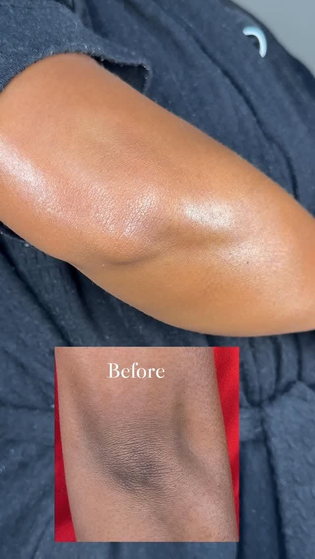 Tono de Seda - Jabon aclarador de zonas con hiperpigmentacion.