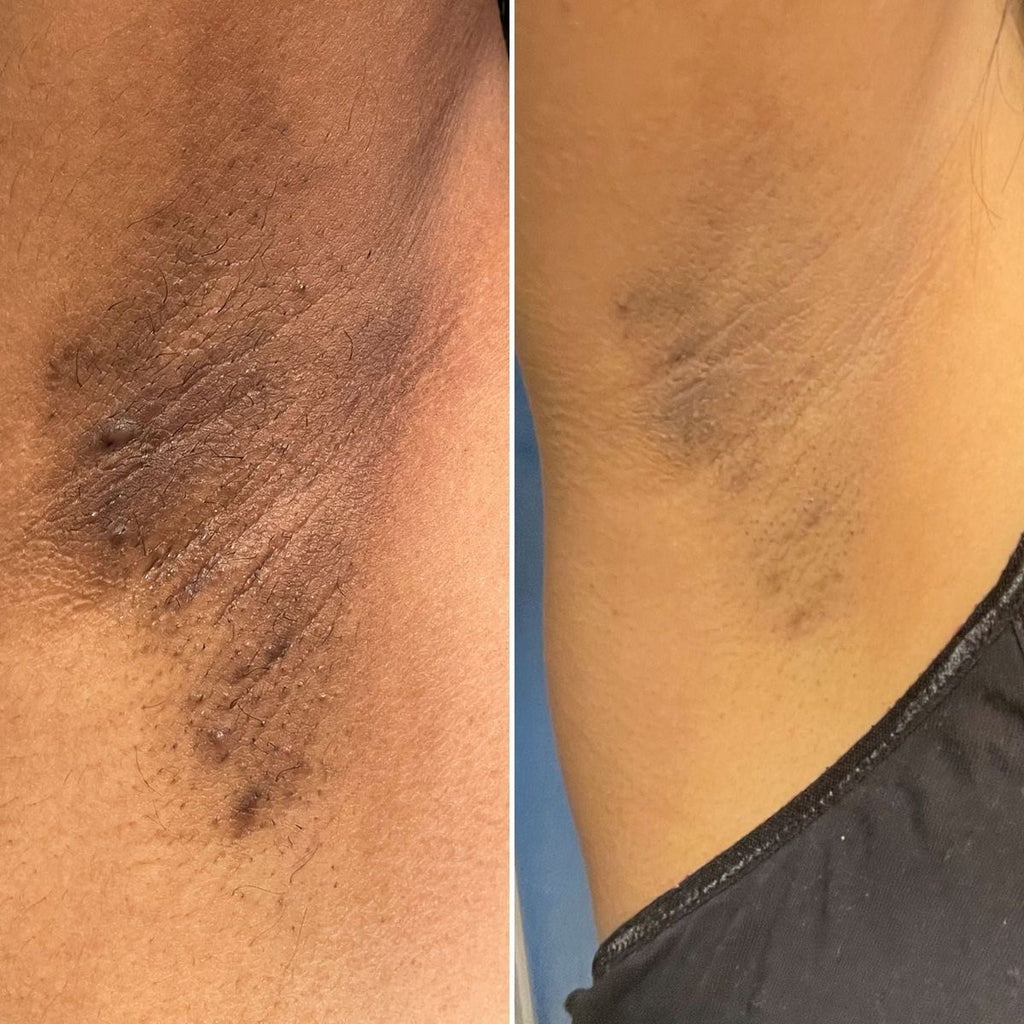 Even Tone Body Duo