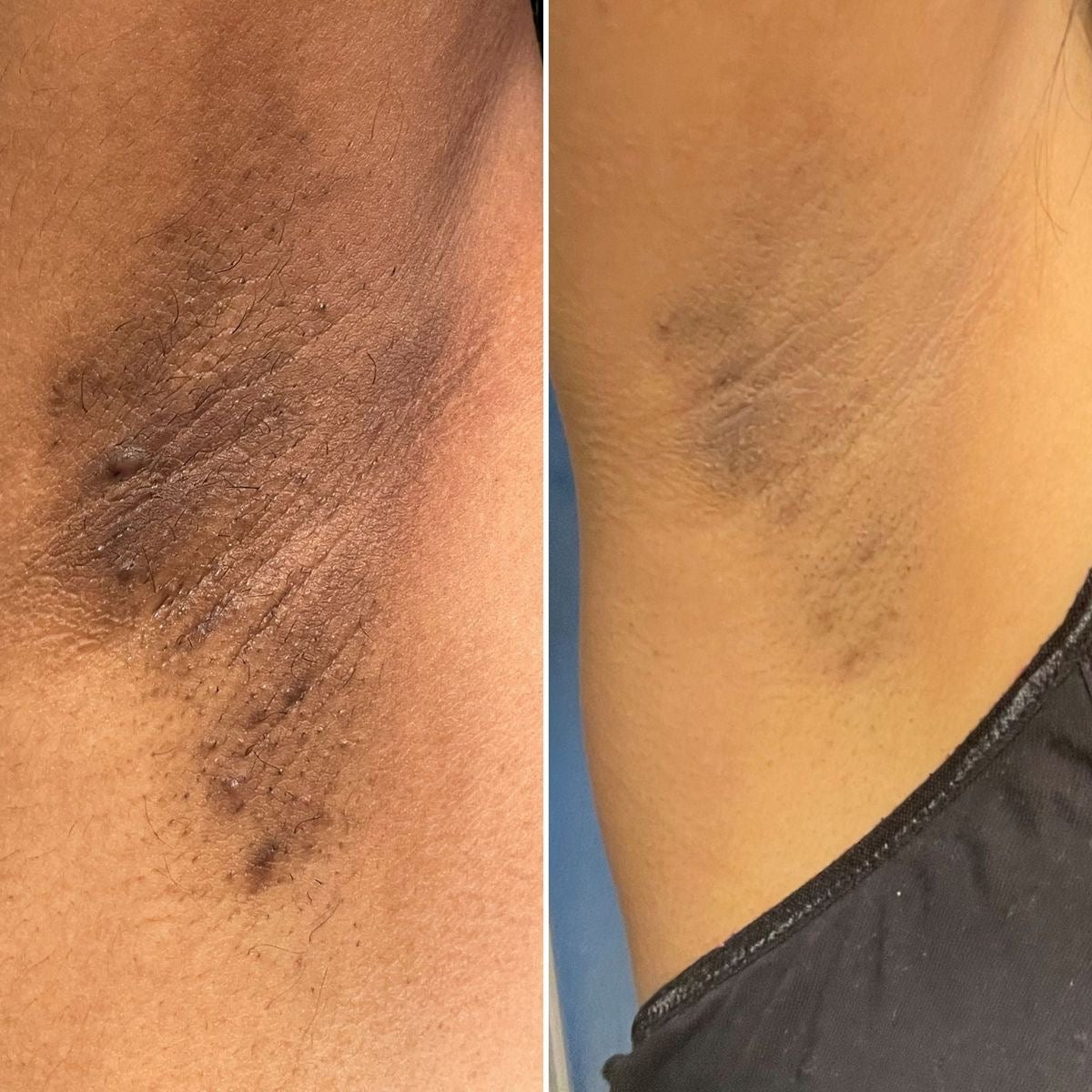 Even Tone Body Duo